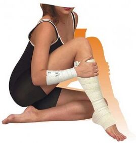 Additional therapy for varicose veins