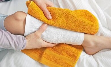 treatment of varicose veins with home remedies