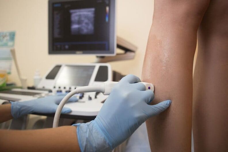 Ultrasound diagnosis of varicose veins.